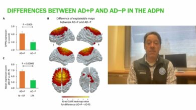 alzheimer